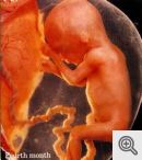 4 month fetus