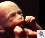 6 Month Unborn Baby